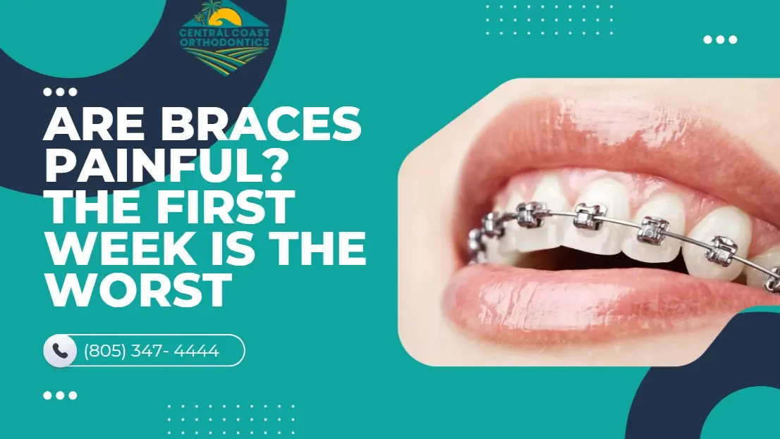 Adult Braces in Santa Maria