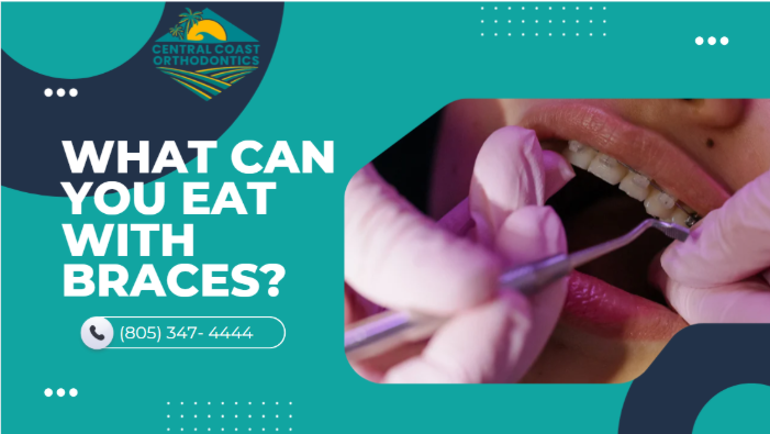 What Can You Eat With Braces?