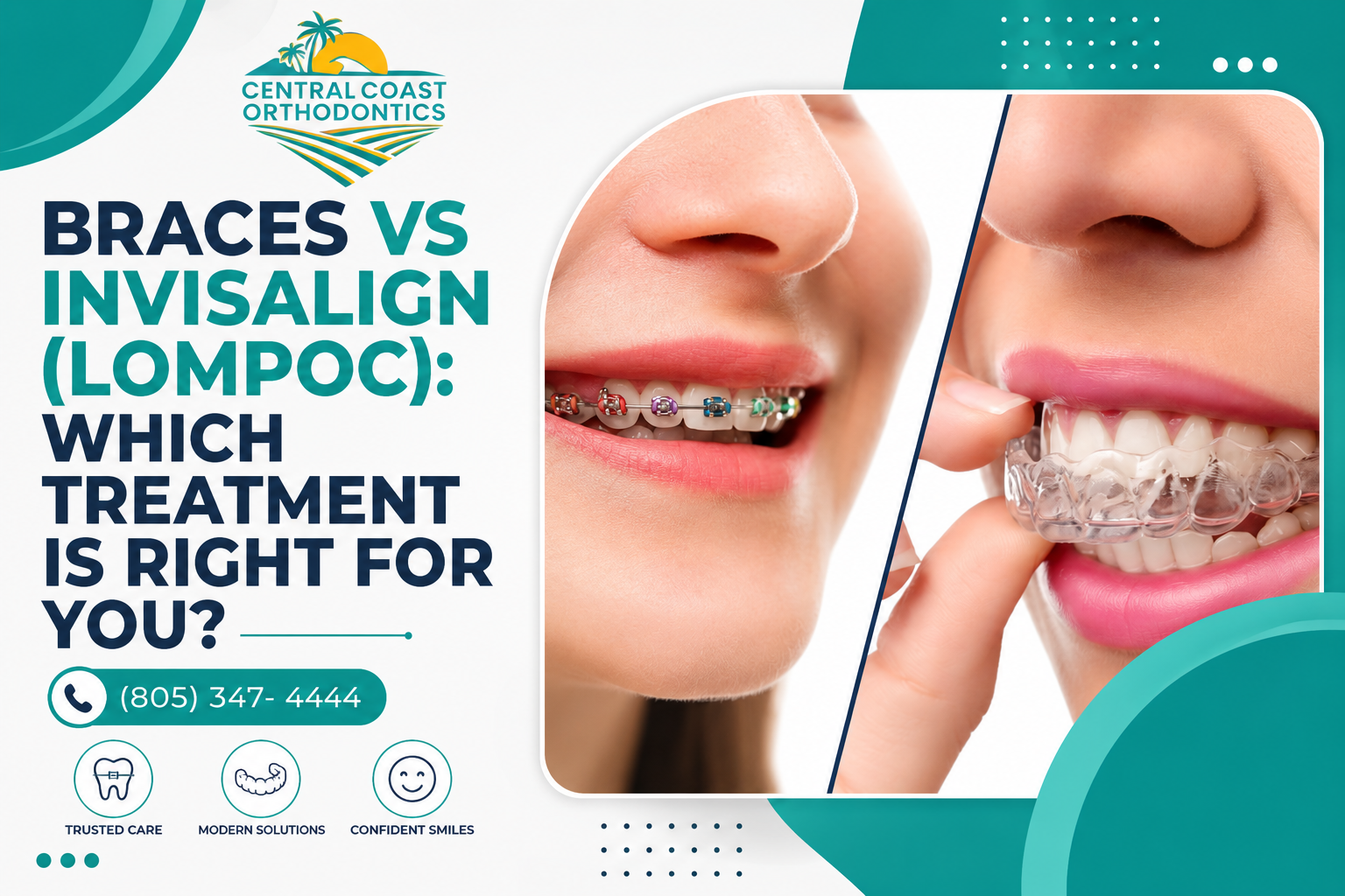 Braces vs Invisalign Lompoc