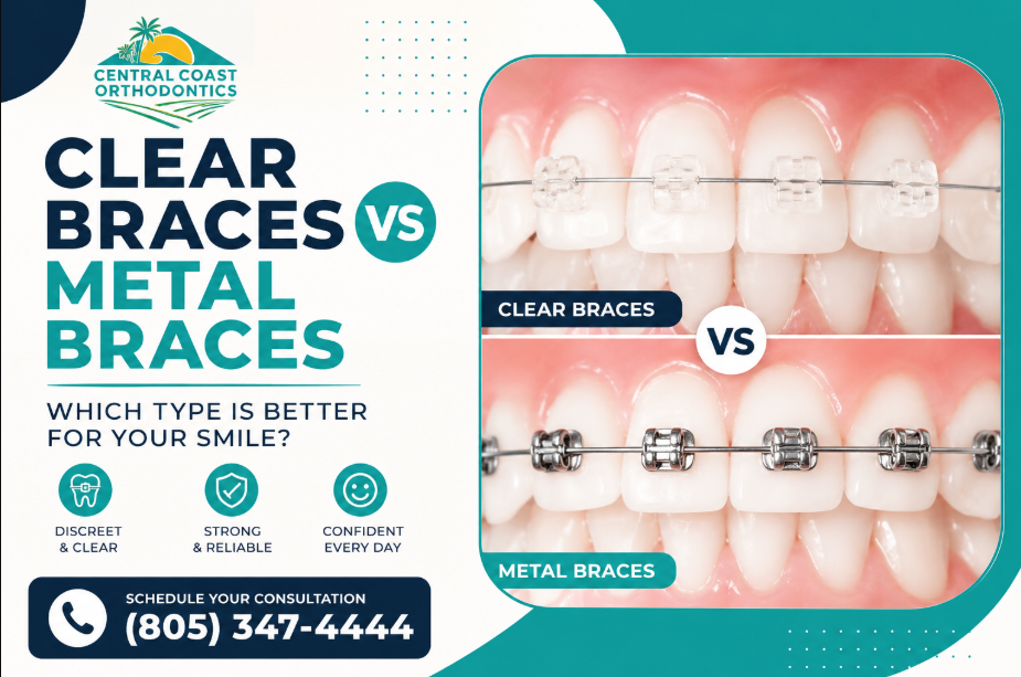 Clear Braces vs Metal Braces