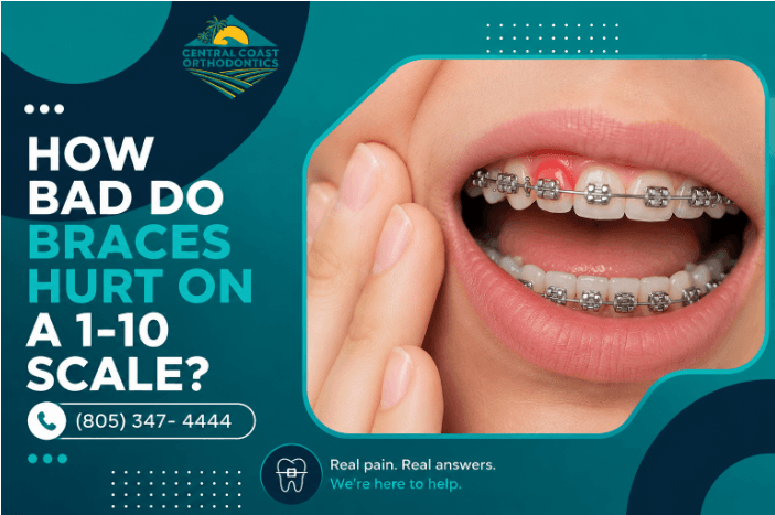 How Bad Do Braces Hurt on a 1-10 Scale