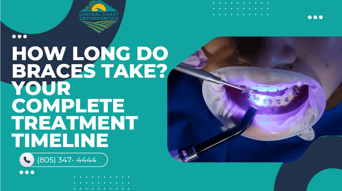 How Long Do Braces Take