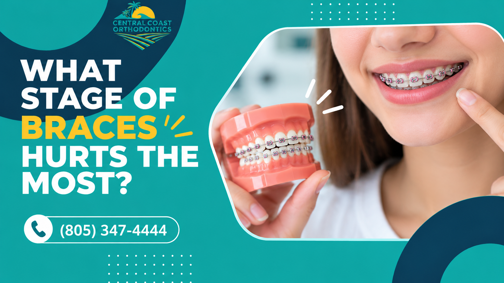 What Stage of Braces Hurts the Most
